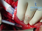 Откуда берутся стволовые клетки Откуда берутся стволовые клетки