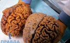 Почему уменьшился мозг  человека