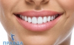 Виниры на зубы: стоматология, цены и поиск