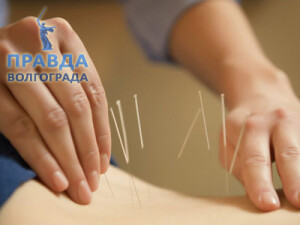 аккупунтура