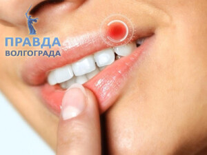 герпес